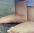 Обнаружено тело 3-летнего татарстанца с признаками падения с высоты - Бугульминская газета